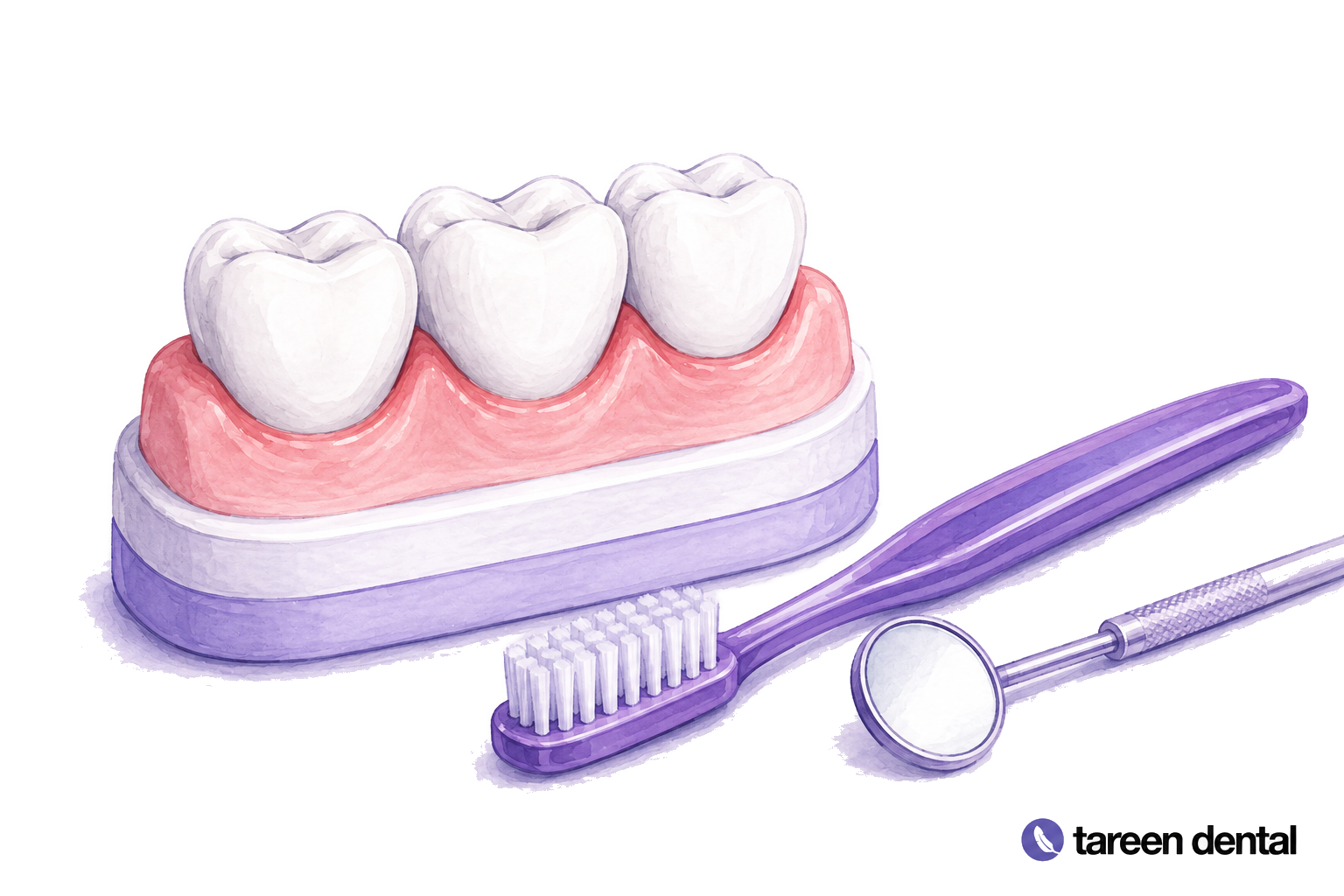 Dental teaching model with reddened gum margins beside a soft toothbrush and dental mirror.