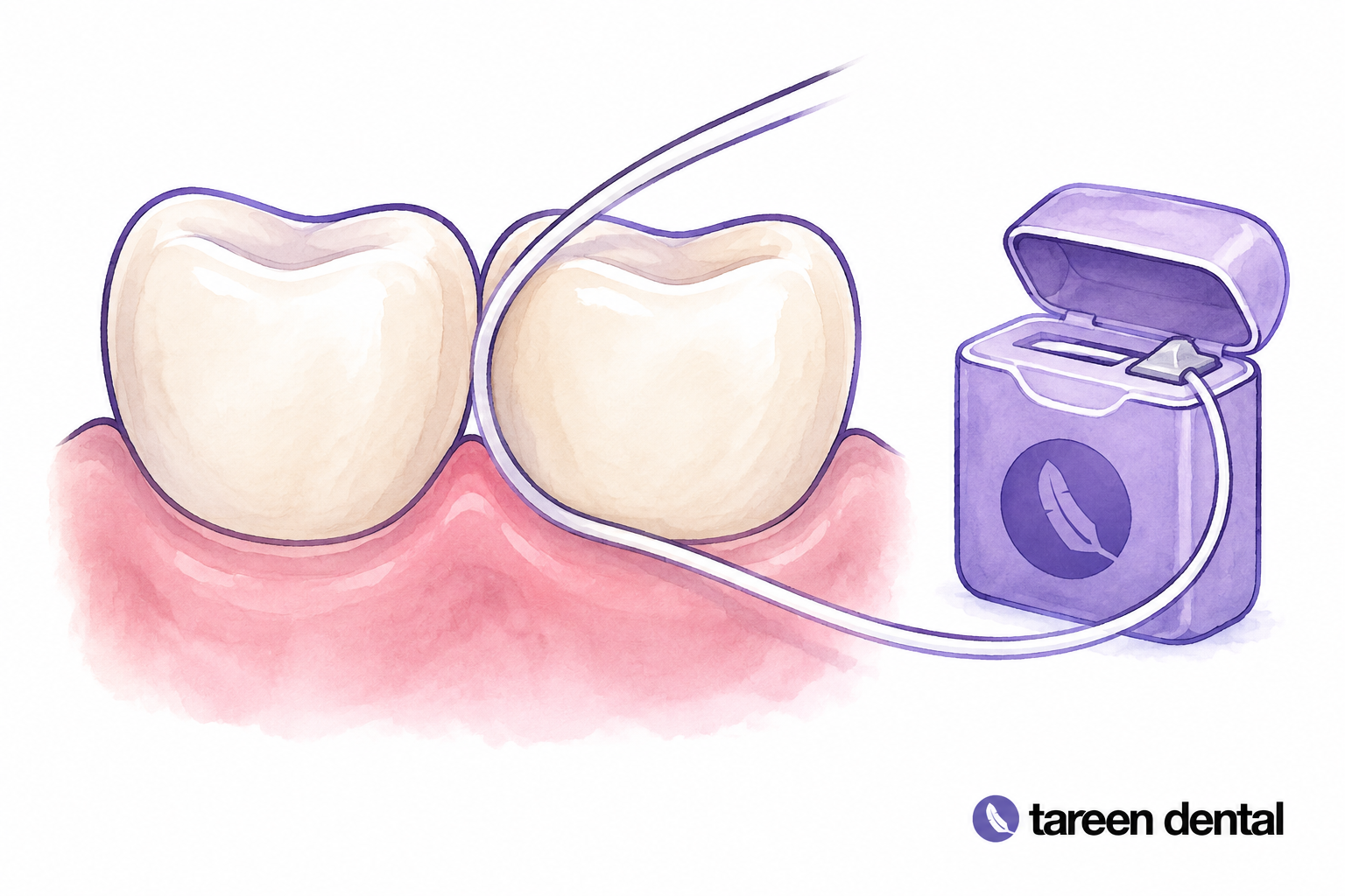 Dental floss demonstrating cleaning between model teeth.