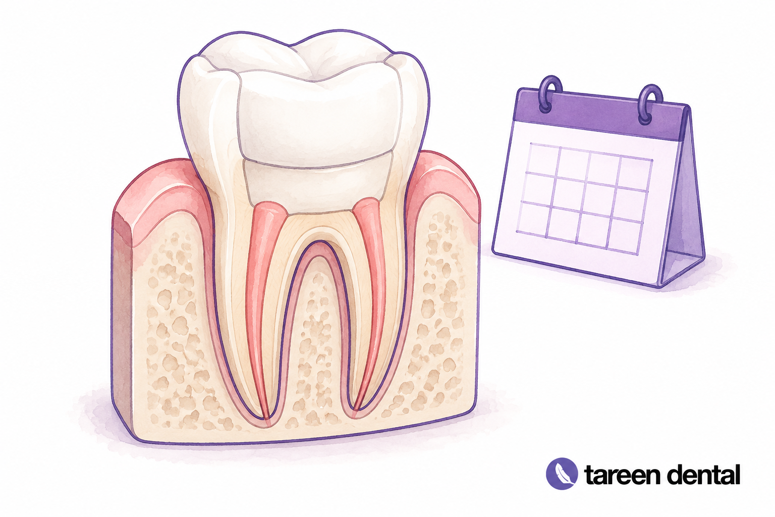 Tooth cross-section model illustrating root canal treatment.