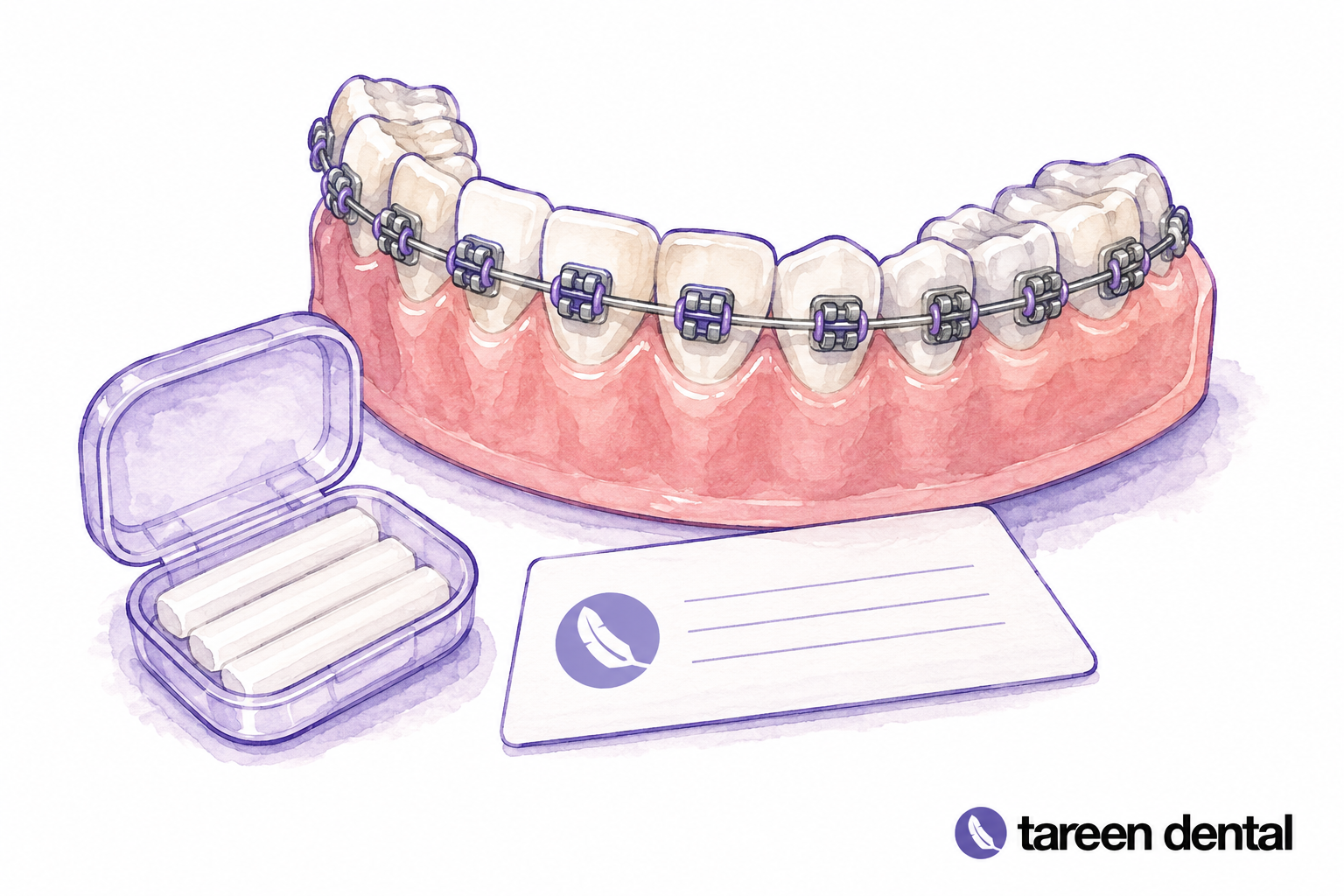 Orthodontic braces model with aftercare accessories.